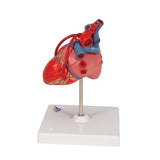 Classic Human Heart Model with Bypass, 2 part - 3B Smart Anatomy