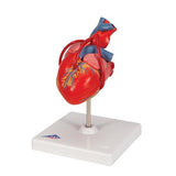 Classic Human Heart Model with Bypass, 2 part - 3B Smart Anatomy