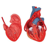Classic Human Heart Model with Bypass, 2 part - 3B Smart Anatomy