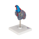 Classic Human Heart Model with Conducting System, 2 part - 3B Smart Anatomy