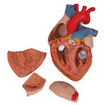 Human Heart Model, 2-times Life-Size, 4 part - 3B Smart Anatomy