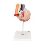 Human Heart Model with Esophagus and Trachea, 2 times Life-Size, 5 part - 3B Smart Anatomy