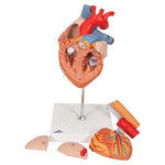 Human Heart Model with Esophagus and Trachea, 2 times Life-Size, 5 part - 3B Smart Anatomy