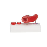 Arteriosclerosis Model, with Cross Section of Artery, 2 part - 3B Smart Anatomy