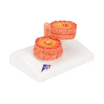 COPD Bronchial Tissue Model - 3B Smart Anatomy