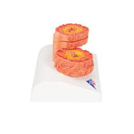COPD Bronchial Tissue Model - 3B Smart Anatomy
