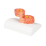 COPD Bronchial Tissue Model - 3B Smart Anatomy