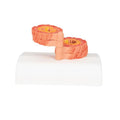 COPD Bronchial Tissue Model - 3B Smart Anatomy