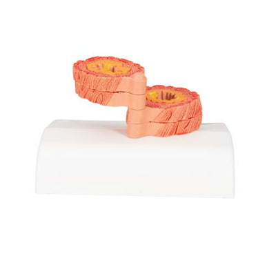 COPD Bronchial Tissue Model - 3B Smart Anatomy