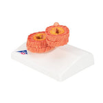 COPD Bronchial Tissue Model - 3B Smart Anatomy
