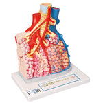 Model of Pulmonary Lobule with Surrounding Blood Vessels, 130 times Magnified - 3B Smart Anatomy
