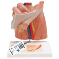 Inguinal Hernia Urology Model - 3B Smart Anatomy
