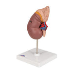 Kidney Model with Adrenal Gland, 2 part - 3B Smart Anatomy