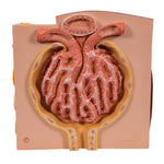 3B MICROanatomy™ Kidney Model - 3B Smart Anatomy