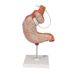Human Stomach Model with Gastric Band, 2 part - 3B Smart Anatomy