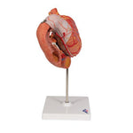 Human Stomach Model, 3 part - 3B Smart Anatomy