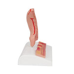 Human Stomach Section Model with Ulcers - 3B Smart Anatomy