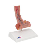 Life-Size Human Esophagus Diseases Model - 3B Smart Anatomy