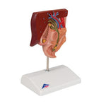 Gallstone Model - 3B Smart Anatomy