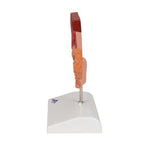 Gallstone Model - 3B Smart Anatomy