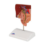 Gallstone Model - 3B Smart Anatomy