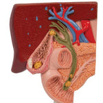 Gallstone Model - 3B Smart Anatomy