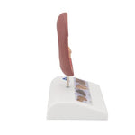 Kidney Stone Model - 3B Smart Anatomy
