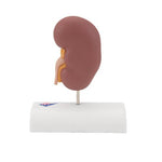 Kidney Stone Model - 3B Smart Anatomy