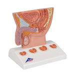 Prostate Model, 1/2 Natural Size - 3B Smart Anatomy