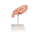 Fetus Model, 5th Month in Breech Position - 3B Smart Anatomy