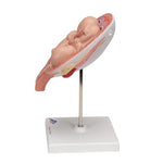Twin Fetuses Model, 5th Month in Normal Position - 3B Smart Anatomy