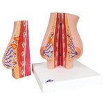 Model of Female Breast with Healthy & Unhealthy Tissue - 3B Smart Anatomy