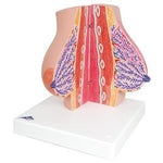 Model of Female Breast with Healthy & Unhealthy Tissue - 3B Smart Anatomy