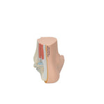 Flat Foot (Pes Planus) Model - 3B Smart Anatomy