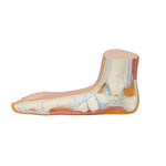 Flat Foot (Pes Planus) Model - 3B Smart Anatomy