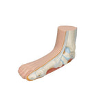 Flat Foot (Pes Planus) Model - 3B Smart Anatomy