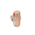 Hollow Foot (Pes Cavus) Model - 3B Smart Anatomy