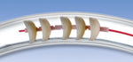 ScopeValet™ Pull Thru™  Single Procedure User Packs & Stubby Brush - 5mm x 2200mm | Case of 60