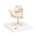 Milk Denture Model with Remaining Teeth - 3B Smart Anatomy