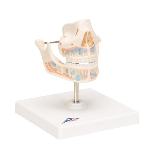 Milk Denture Model with Remaining Teeth - 3B Smart Anatomy