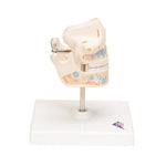 Milk Denture Model with Remaining Teeth - 3B Smart Anatomy