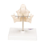 Milk Denture Model with Remaining Teeth - 3B Smart Anatomy