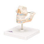 Milk Denture Model with Remaining Teeth - 3B Smart Anatomy