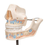 Milk Denture Model with Remaining Teeth - 3B Smart Anatomy