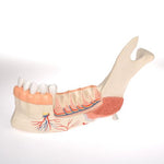 Comprehensive Lower Jaw Model (Left Half) with Diseased Teeth, Nerves, Vessels & Glands, 19 part - 3B Smart Anatomy