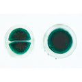 Algae - Spanish