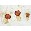 Fungi and Lichen - Portuguese Slides
