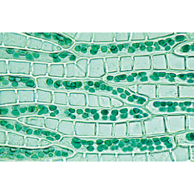 Bryophyta (Liverworts and Mosses) - French