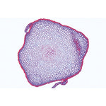 Bryophyta (Liverworts and Mosses) - French