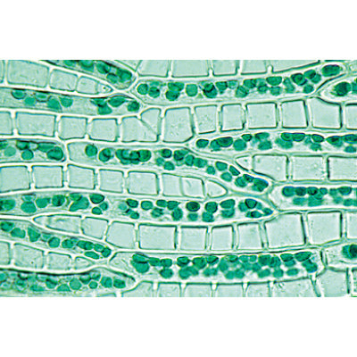 Bryophyta (Liverworts and Mosses) - Spanish